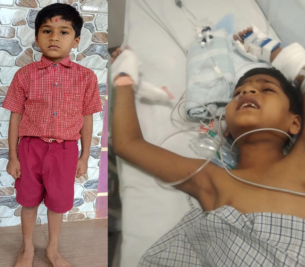 Five-year-old Bhatkal boy battles life-threatening liver disease; family appeals for public support