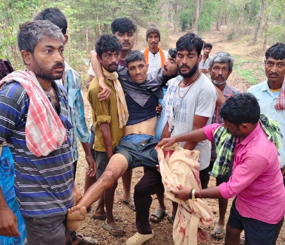 Man survives Bear attack in Mundgod