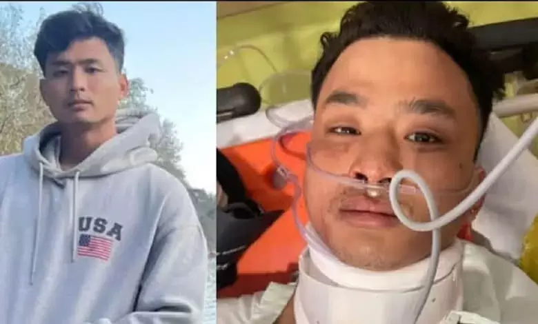 SC PIL seeks urgent action against racial violence targeting people from Northeast